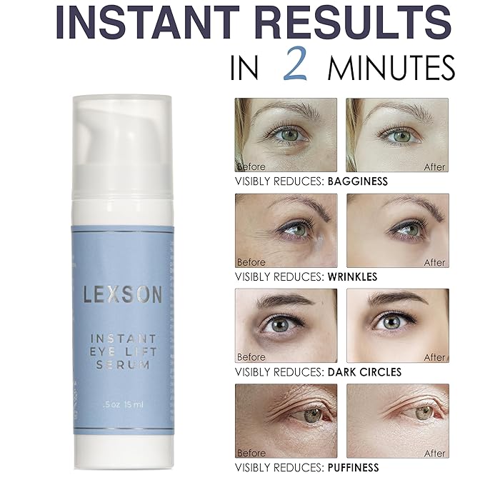 Instant Eye Lift Serum - Provides Immediate Visible Results, Lifts Away Appearance of Lines & Wrinkles. Dark Circles Under Eye Treatment, Eye Cream for Dark Circles and Puffiness-GlimoraGlow