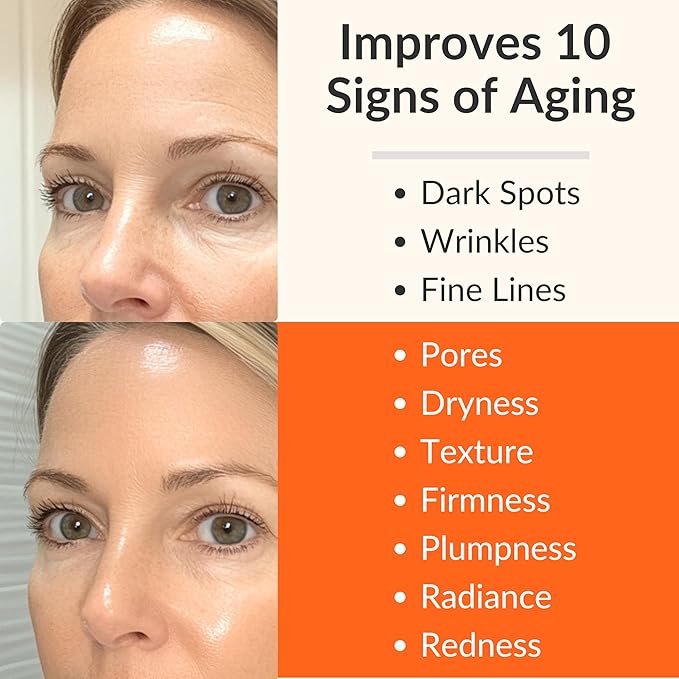 LeVaye Vitamin C Serum, Anti-Aging Face Serum – 15% Vitamin C, Ferulic Acid, Niacinamide, Hyaluronic Acid, Peptides, Ceramides – Targets Wrinkles, Fine Lines, Dark Spots, Enlarged Pores, Dry Skin-GlimoraGlow