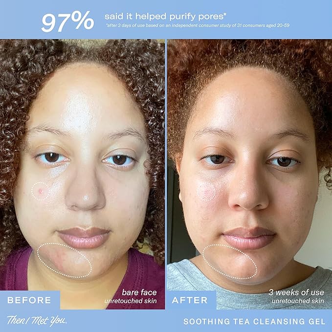 Then I Met You Soothing Tea Cleansing Gel, Hydrating Water-Based Face Cleanser with Fermented Rice Water & Green Tea, Vegan & Clean Skincare, 3.38 oz-GlimoraGlow