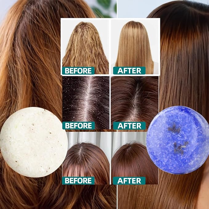 2 Pack Rosemary Lavender Hair Shampoo Bar,Deep Cleansing for Scalp Hair Loss Shampoo Soap,Organic Shampoo Oil Control for Hair Growth,Refreshing and Hydrating Bar,Gifts for Women Men-GlimoraGlow