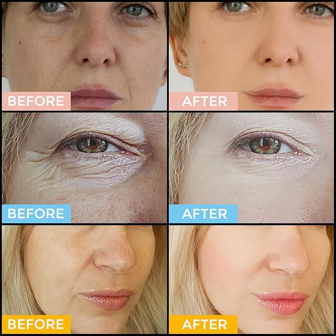 Facial Skin Care Set– Retinol Serum, Vitamin C & Hyaluronic Acid for Face – Anti Aging Face Serum Set for Women – Firm, Wrinkle Smoothing, Dark Spot Corrector, Brighten Dullness-GlimoraGlow