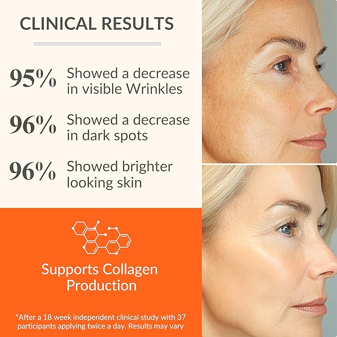 LeVaye Vitamin C Serum, Anti-Aging Face Serum – 15% Vitamin C, Ferulic Acid, Niacinamide, Hyaluronic Acid, Peptides, Ceramides – Targets Wrinkles, Fine Lines, Dark Spots, Enlarged Pores, Dry Skin-GlimoraGlow