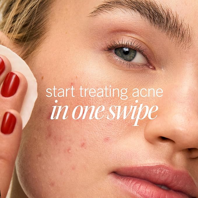 First Aid Beauty Acne Pads for Face - Maximum Strength Acne Treatment - 2% Salicylic Acid Pads Treat Without Drying, (60-ct)-GlimoraGlow