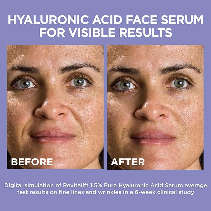 L'Oreal Paris Revitalift 1.5% Pure Hyaluronic Acid Face Serum 1.0 oz + True Match Lumi Glotion Natural Glow Enhancer Lotion, Medium 1.35 fl. oz, 1 kit-GlimoraGlow