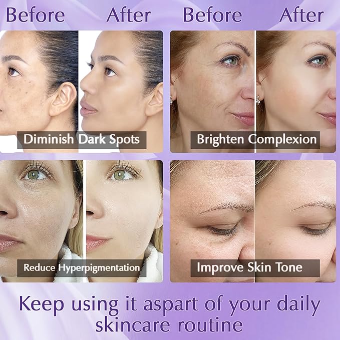 Dark Spot Remover for Face Cream, Dark Spot Corrector, Rapid Tone Repair Retinol Serum for Sun Spots, Age Spots, Skin Brown, Melasma Skin Care with Upgraded Formula Vitamin C for Women 1.7 Fl OZ-GlimoraGlow