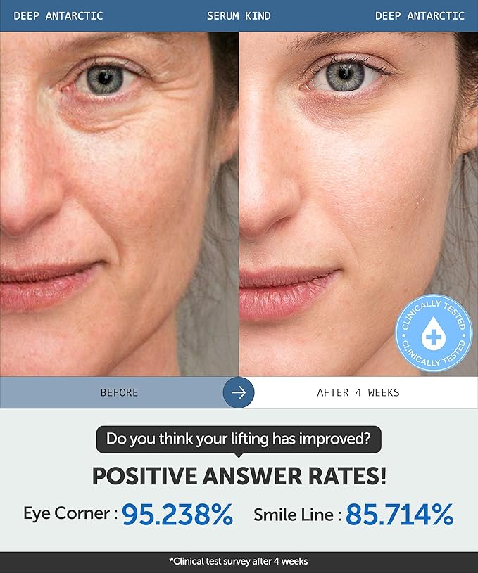 SERUMKIND Deep Antarctic Serum - Lifting, Plumping Korean Skincare – Antarcticine™ Marine Ingredient and Beta Glucan – Improves Elasticity and Firming - Vegan, Cruelty Free, Unscented – 1.01 fl.oz.-GlimoraGlow