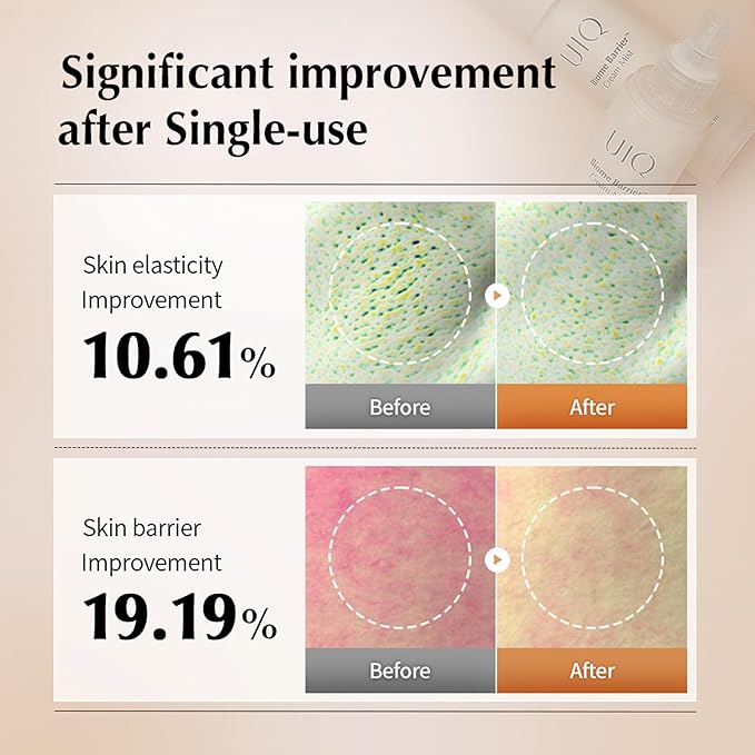 UIQ Biome Barrier Cream Mist - Facial Barrier Mist for Hydration & Skin Barrier Repair, Microbiome-Based Korean Skin Care, 3.38 fl oz-GlimoraGlow
