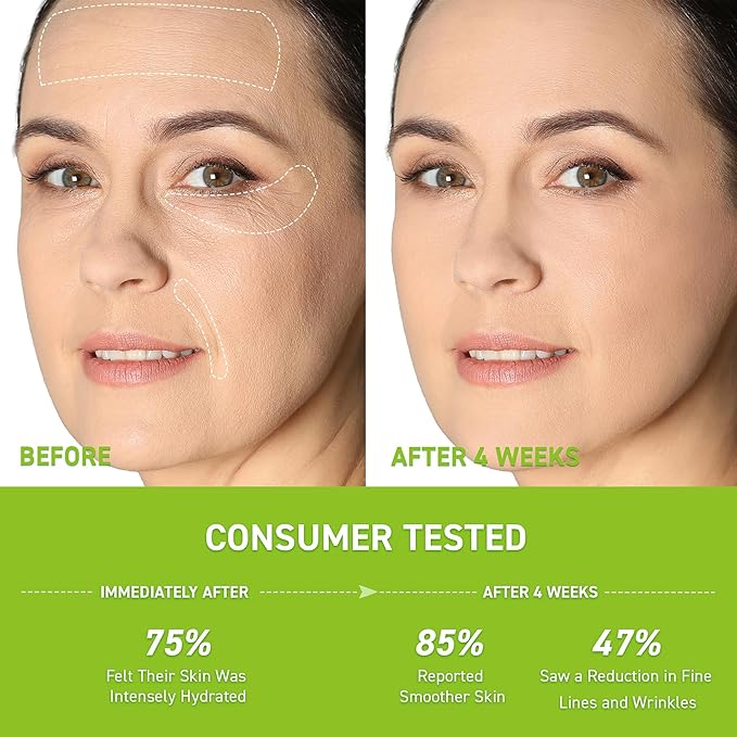 Anti-Wrinkle Retinol Serum for Face: Anti Aging Firming Skin Treatment with Hyaluronic Acid & Collagen - Deep Hydration Facial Care for Women Over 30，Daily & Night Use, 1.0 fl.oz-GlimoraGlow