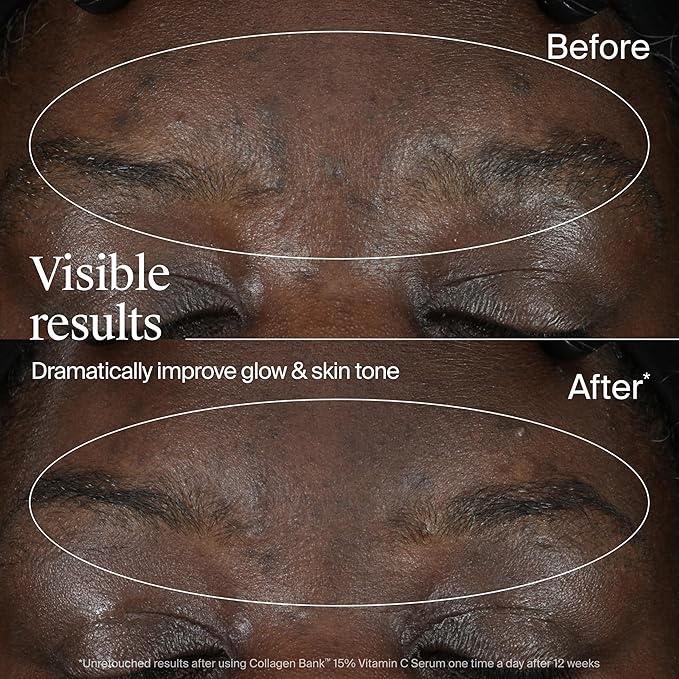 Neutrogena Collagen Bank 15% Vitamin C Face Serum, Vitamin C Serum for Face Helps Build Collagen for Glowing, Plumper Looking Skin, Uneven Skin Tone Treatment, Fragrance Free, 0.5 fl. oz-GlimoraGlow