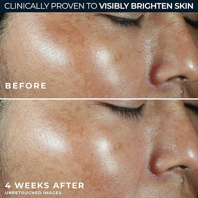 RoC Multi Correxion Revive + Glow Vitamin C Sunscreen Broad Spectrum SPF 30 Face Moisturizer (1.7 oz) with Retinol Eye Cream Packette-GlimoraGlow