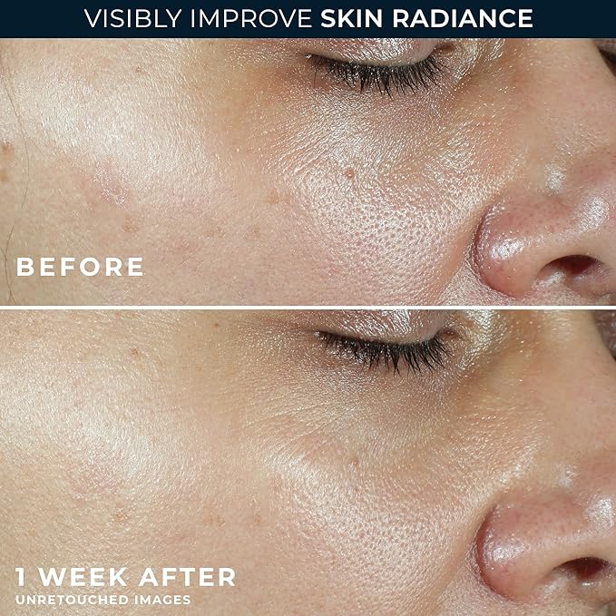 RoC Multi Correxion Revive + Glow Vitamin C Sunscreen Broad Spectrum SPF 30 Face Moisturizer (1.7 oz) with Retinol Eye Cream Packette-GlimoraGlow