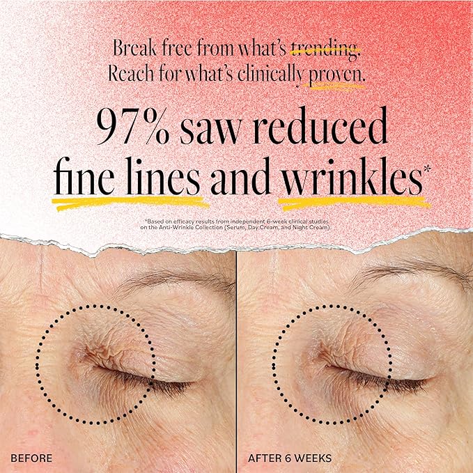 DERMA E Face Serum, Anti Aging Regenerative Retinol Serum for Face, 1 Fl Oz, Vitamin A, Bakuchiol, Glycolic Acid, Green Tea Extract, Helps Reduce Appearance of Fine Lines and Wrinkles-GlimoraGlow