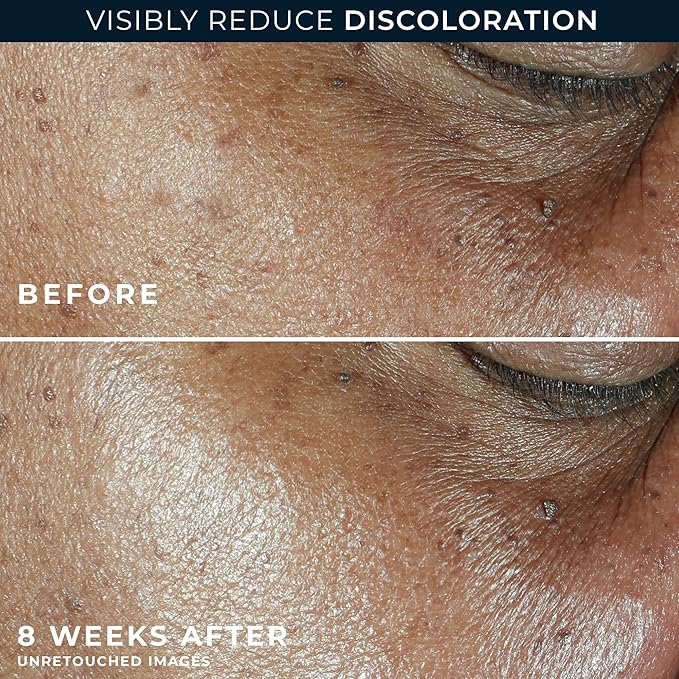 RoC Multi Correxion 5 in 1 Anti-Aging Daily Facial Moisturizer for Women and Men, Broad Spectrum SPF 30 & Shea Butter (1.7 oz) with Night Cream Packette (Packaging May Vary)-GlimoraGlow