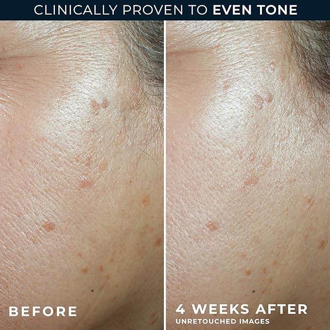 RoC Multi Correxion 5 in 1 Anti-Aging Daily Facial Moisturizer for Women and Men, Broad Spectrum SPF 30 & Shea Butter (1.7 oz) with Night Cream Packette (Packaging May Vary)-GlimoraGlow