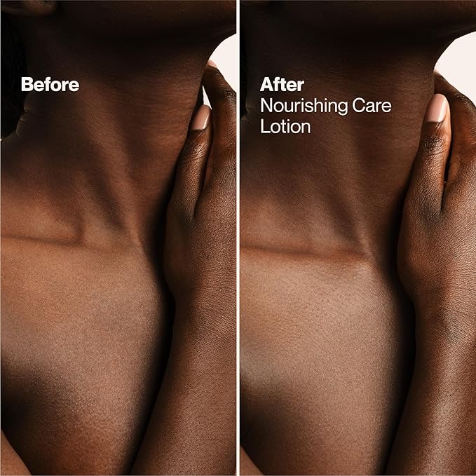 Suave Nourishing Care Hand & Body Lotion with Shea Butter for Women, Deep Moisture for Dry Skin, Fast Absorbing, Allergen Free Moisturizing Cream, 18FL OZ, 6 Pack-GlimoraGlow