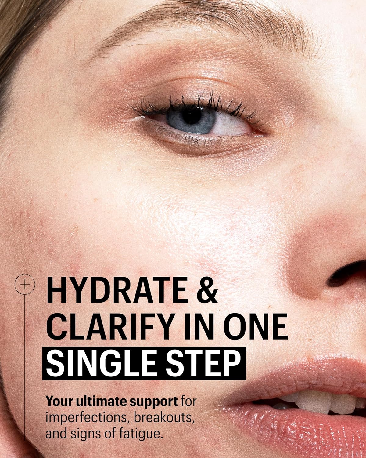 Allies of Skin Multi Nutrient & Dioic Renewing Cream: Moisturizer with Dioic Acid, 14 Antioxidants, Probiotics & Centella Asiatica. Targets Imperfections, Brightens & Protects Skin 1.7 oz / 50 ml-GlimoraGlow