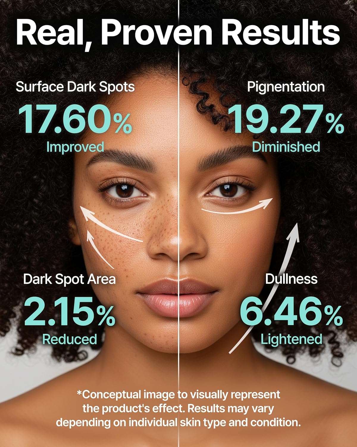 Charde Niacinamide 25% Snow Ampoule for Face, Dark Spot Care for Hyperpigmentation, Freckles & Sun Spots | Radiance Boosting with White Garcinia & Arbutin, Korean Skin Care, 1.01 fl. oz.-GlimoraGlow